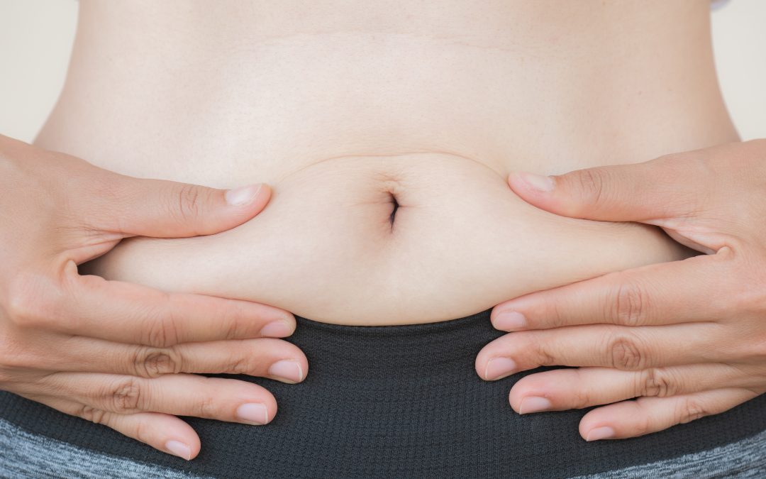 Diástasis abdominal: Tratamiento efectivo con fisioterapia del suelo pélvico
